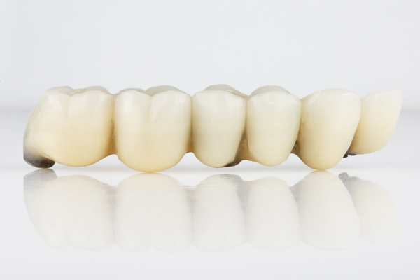 Dental Implants And Bridges To Replace Multiple Missing Teeth