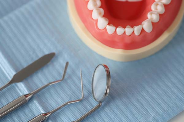 How Long Dentures May Last